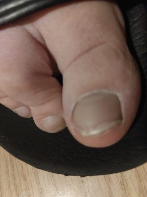 Socken/füße