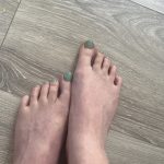 Fußbilder