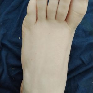 Mein linker fuss