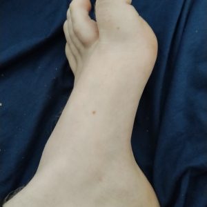 Mein linker fuss