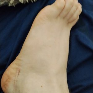 Mein linker fuss